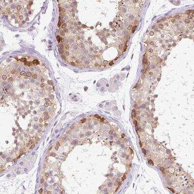 Immunohistochemistry-Paraffin: Nesprin-3 Antibody [NBP2-49175] - Staining of human testis shows distinct nuclear membranous and cytoplasmic positivity in cells in seminiferous ducts.