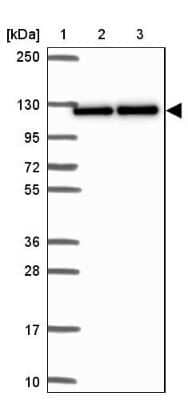 Western Blot: Nesprin-3 Antibody [NBP2-49175] - Lane 1: Marker [kDa] 250, 130, 95, 72, 55, 36, 28, 17, 10Lane 2: Human cell line RT-4Lane 3: Human cell line U-251MG sp