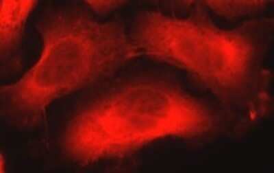 Immunocytochemistry/Immunofluorescence: Nestin Antibody (10C2) - Azide and BSA Free [NBP2-80869] - Visualization of Nestin in PC-3 cells using NB300-266. Courtesy of Dolnick Lab, Roswell Park Cancer Institute. Image from the standard format of this antibody.