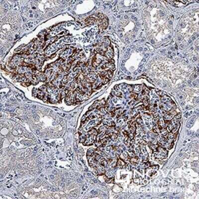 Immunocytochemistry: Nestin Antibody (10C2) - Azide and BSA Free [NBP2-80869] - Nestin was detected in immersion fixed paraffin-embedded sections of human kidney using anti-human mouse monoclonal antibody (Catalog # NB300-266) at 1:500 dilution overnight at 4C. Tissue was stained using the VisuCyte anti-mouse HRP polymer detection re