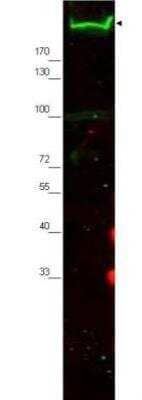 Western Blot: Nestin Antibody [NBP1-02419] - Affinity Purified anti-Nestin antibody shows detection of a band ~220 kD corresponding to mouse Nestin (arrowhead). Approximately 30 g of MEF whole cell lysate was separated by SDS-PAGE using a 4-20% gradient gel. After transfer onto nitrocellulose, the membrane was blocked and then probed with the primary antibody diluted to 1:2000 overnight at 4C. The membrane was then washed and reacted with a 1:10000 dilution of IRDye800 conjugated Gt-a-Rabbit IgG [H&L] MX ( for 45 min at room temperature.
