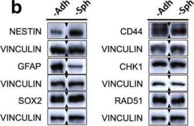 Western Blot: Nestin Antibody [NBP1-02419] - Densitometric analysis revealed a significant reduction of GFAP and a significant increase of NESTIN in U251MG-Sph compared to U251MG-Adh. Image collected and cropped by CiteAb from the following publication (jeccr.biomedcentral.com/articles/10.1186/s13046-019-1293-x), licensed under a CC-BY license.