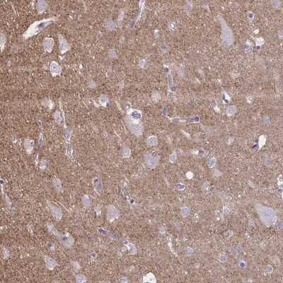Immunohistochemistry-Paraffin: Netrin-1 Antibody [NBP2-31640] - Staining of human cerebral cortex shows cytoplasmic  positivity in processes.