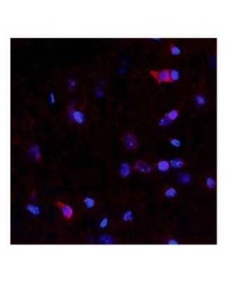 Immunohistochemistry-Paraffin: Netrin-4 Antibody [NBP1-91343] - Rat and mouse brain, 10 ug/ml.  Observed staining in cytoplasmin neurons