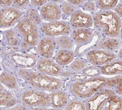 Immunohistochemistry-Paraffin: Netrin-4 Antibody [NBP2-13680] - Staining of human kidney shows moderate membranous and cytoplasmic positivity in cells in tubules.