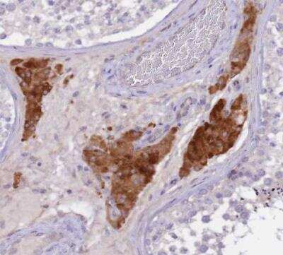 Immunohistochemistry-Paraffin: Netrin-4 Antibody [NBP2-13680] - Staining of human testis shows moderate cytoplasmic positivity in Leydig cells.
