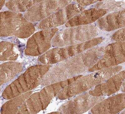 Immunohistochemistry-Paraffin: Netrin-4 Antibody [NBP2-13680] - Staining of human skeletal muscle shows moderate cytoplasmic positivity in myocytes.