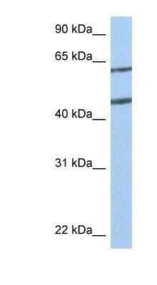 Western Blot: Netrin-4 Antibody [NBP1-91343] - Suggested Antibody Titration: 0.2-1 ug/ml Positive Control: MCF7 cell lysate