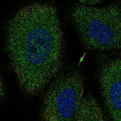 Immunocytochemistry/Immunofluorescence: Netrin G2 Antibody [NBP2-68828] - Staining of human cell line A549 shows localization to plasma membrane, cytosol, cytokinetic bridge & midbody ring.