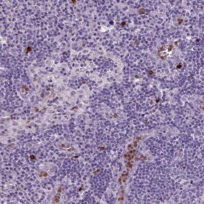 Immunohistochemistry: Netrin G2 Antibody [NBP2-49653] - Staining of human lymph node shows strong cytoplasmic positivity in subset of non-germinal center cells.