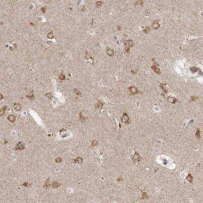 Immunohistochemistry: Neudesin Antibody [NBP2-13652] - Staining of human lateral ventricle shows moderate cytoplasmic positivity in neurons.