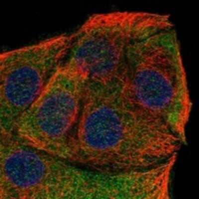 Immunocytochemistry/Immunofluorescence: Neuferricin Antibody [NBP3-17522] - Staining of human cell line HaCaT shows localization to plasma membrane & endoplasmic reticulum.