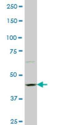 Western Blot: Neurabin 1 Antibody (6A10) [H00055607-M01] - PPP1R9A monoclonal antibody (M01), clone 6A10 Western Blot analysis of PPP1R9A expression in PC-12 ( Cat # L012V1 ).