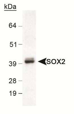 Western Blot: Neural Stem Cell Marker Antibody Pack [NBP1-42826] - Detection of SOX2 in mouse brain lysate using NB110-37235 (0.5ug/ml).