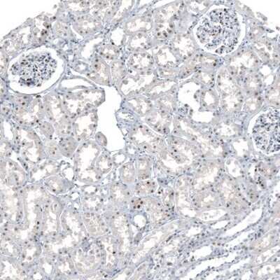 Immunohistochemistry-Paraffin: Neuregulin-1/NRG1 Antibody [NBP1-81834] - Staining of human kidney shows moderate nuclear positivity in cells in glomeruli and cells in tubules.