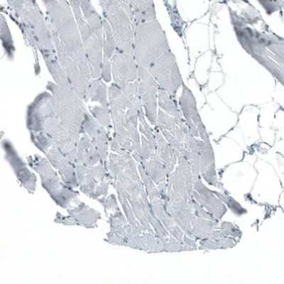 Immunohistochemistry-Paraffin: Neuregulin-1/NRG1 Antibody [NBP1-81834] - Staining of human skeletal muscle shows no positivity in myocytes as expected.