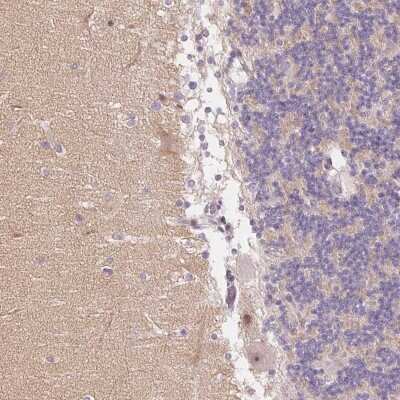 Immunohistochemistry-Paraffin Neuregulin-2 Antibody