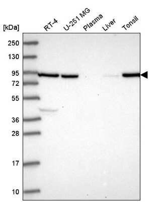 Western Blot Neuregulin-2 Antibody