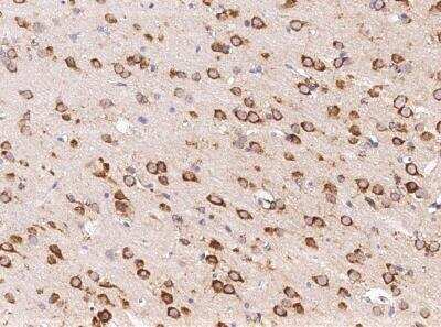 Immunohistochemistry-Paraffin: Neurexophilin-1 Antibody (001) [NBP2-90866] - Immunochemical staining of rat NXPH1 in rat brain with rabbit monoclonal antibody (1:20000, formalin-fixed paraffin embedded sections).