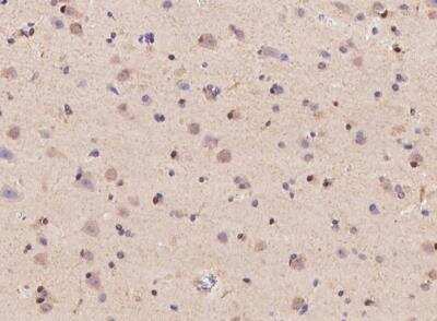 Immunohistochemistry-Paraffin: Neurexophilin 2 Antibody [NBP3-05854] - Staining of human NXPH2 in human brain with rabbit polyclonal antibody at 1:500 dilution.