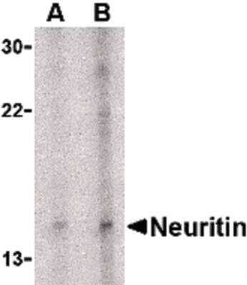 Western Blot: Neuritin Antibody [NBP1-03026] - Daudi cell lysate with neuritin antibody at (A) 5 and (B) 10 ug/ml.