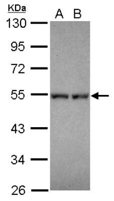 Western Blot: Neuro D4 Antibody [NBP2-19518] - Sample (30 ug of whole cell lysate) A: IMR32 B: U87-MG 10% SDS PAGE gel, diluted at 1:1000.