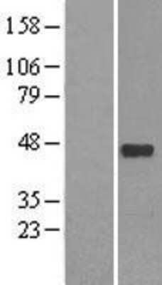 Western Blot: NeuroD1 Overexpression Lysate (Adult Normal) [NBL1-13598] Left-Empty vector transfected control cell lysate (HEK293 cell lysate); Right -Over-expression Lysate for NeuroD1.