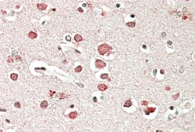 Immunohistochemistry-Paraffin: Neurobeachin Antibody [NB100-55385] - Human Cerebral Cortex. Steamed antigen retrieval with citrate buffer pH 6, AP-staining. Antibody at 5 ug/mL.