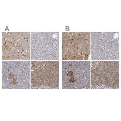 <b>Independent Antibodies Validation and Orthogonal Strategies Validation.</b>Immunohistochemistry-Paraffin: Neurobeachin Antibody [NBP1-90004] - Staining of human cerebral cortex, liver, pancreas and stomach using Anti-NBEA antibody NBP1-90004 (A) shows similar protein distribution across tissues to independent antibody NBP1-90003 (B).