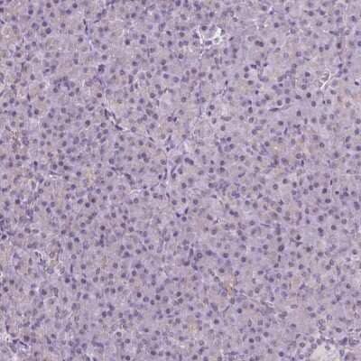 Immunohistochemistry-Paraffin Neurocan Antibody - BSA Free