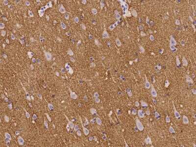 Immunohistochemistry-Paraffin: Neurocan Antibody [NBP2-98027] - Immunochemical staining of human Neurocan in human brain with rabbit polyclonal antibody at 1:100 dilution, formalin-fixed paraffin embedded sections.