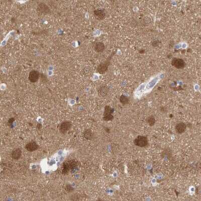 Immunohistochemistry-Paraffin: Neurochondrin Antibody [NBP1-87901] - Staining of human Cerebral cortex shows strong cytoplasmic positivity in neuronal cells.