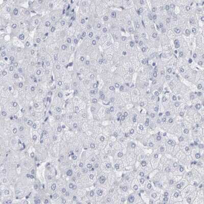 Immunohistochemistry-Paraffin: Neurochondrin Antibody [NBP1-87901] - Staining of human Liver shows no cytoplasmic positivity in hepatocytes as expected.