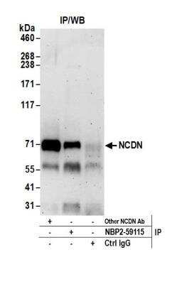 Immunoprecipitation: Neurochondrin Antibody [NBP2-59115] - Detection of human NCDN by western blot of immunoprecipitates. Samples: Whole cell lysate (0.5 or 1.0 mg per IP reaction; 20% of IP loaded) from 293T cells prepared using NETN lysis buffer. Antibodies: Affinity purified rabbit anti-NCDN antibody A305-NBP2-59115 used for IP at 8 ul per reaction. NCDN was also immunoprecipitated by rabbit anti-NCDN antibody. Detection: Chemiluminescence with an exposure time of 3 minutes.