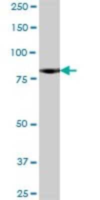 Western Blot: Neurochondrin Antibody [H00023154-B01P] - Analysis of NCDN expression in rat brain.