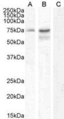 Western Blot: Neurochondrin Antibody [NBP2-75968] - (0.3 ug/mL) HepG2 (A) and (1 ug/mL) U251 cell lysate (B) + peptide (C) (35 ug protein in RIPA buffer). Detected by chemiluminescence.
