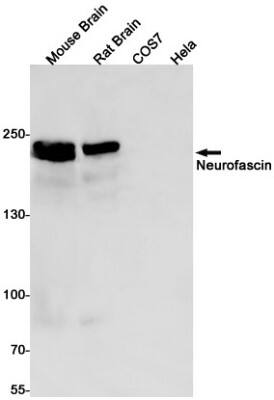 Western Blot: Neurofascin Antibody (S07-0B3) [NBP3-19519] - Western blot detection of Neurofascin in Mouse Brain, Rat Brain, CSO7, Hela cell lysates using NBP3-19519 (1:1000 diluted). Predicted band size: 150kDa. Observed band size: 186, 155, 75kDa.