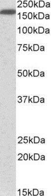 Western Blot: Neurofascin Antibody [NBP1-78794] -  (0.5ug/ml) staining of Human Lung lysate (35ug protein in RIPA buffer). Primary incubation was 1 hour. Detected by chemiluminescence.