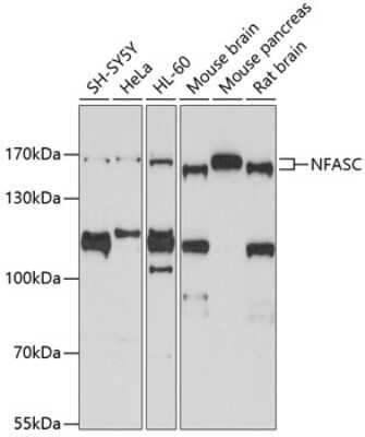 Western Blot: Neurofascin Antibody [NBP2-95191] - Analysis of extracts of various cell lines, using Neurofascin at 1:1000 dilution.Secondary antibody: HRP Goat Anti-Rabbit IgG (H+L) at 1:10000 dilution.Lysates/proteins: 25ug per lane.Blocking buffer: 3% nonfat dry milk in TBST.Detection: ECL Basic Kit .Exposure time: 90s.