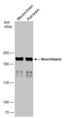 Western Blot: Neurofascin Antibody [NBP3-13182] - Various tissue extracts (10 ug) were separated by 5% SDS-PAGE, and the membrane was blotted with Neurofascin antibody (NBP3-13182) diluted at 1:2000.