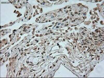 Immunohistochemistry: Neurogenin-1 Antibody (OTI3F9) - Azide and BSA Free [NBP2-72948] - Staining of Human lung tissue.