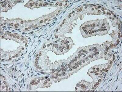 Immunohistochemistry: Neurogenin-1 Antibody (OTI3F9) - Azide and BSA Free [NBP2-72948] - Staining of Human prostate tissue.