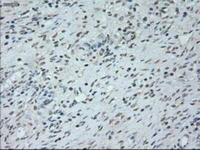 Immunohistochemistry: Neurogenin-1 Antibody (OTI3F9) - Azide and BSA Free [NBP2-72948] - Staining of Human Ovary tissue.