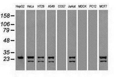 Western Blot: Neurogenin-1 Antibody (OTI3F9) - Azide and BSA Free [NBP2-72948] - Analysis of extracts (35ug) from 9 different cell lines by using anti-Neurogenin 1 monoclonal antibody.