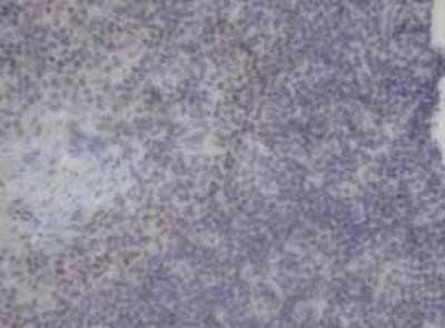 Immunohistochemistry: Neurogenin-3 Antibody (OTI3B5) - Azide and BSA Free [NBP2-72956] - Staining of paraffin-embedded Human lymph node tissue using anti-Neurogenin-3 mouse monoclonal antibody.