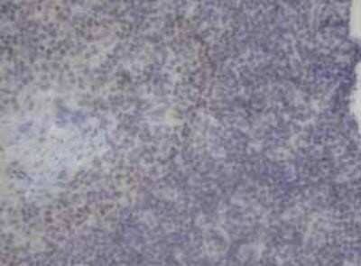 Immunohistochemistry-Paraffin: Neurogenin-3 Antibody (OTI3B5) [NBP1-47878] - Staining of paraffin-embedded Human lymph node tissue using anti-Neurogenin-3 mouse monoclonal antibody.