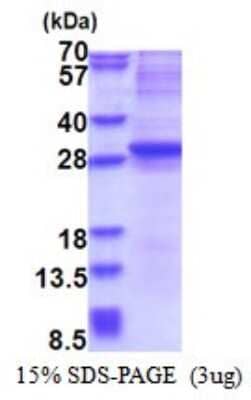 SDS-Page: Recombinant Human Neurogenin-3 Protein [NBP2-51514] - 15% SDS Page (3 ug)