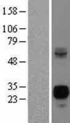 Western Blot Neurogenin-3 Overexpression Lysate