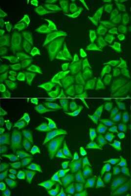 Immunocytochemistry/ Immunofluorescence Neuroglobin Antibody - Azide and BSA Free