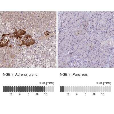 <b>Orthogonal Strategies Validation. </b>Immunohistochemistry-Paraffin: Neuroglobin Antibody [NBP2-48769] - Staining in human adrenal gland and pancreas tissues using anti-NGB antibody. Corresponding NGB RNA-seq data are presented for the same tissues.